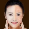 Blue Light Therapy Acne Laser Pen Soft Scar Wrinkle Removal Treatment Device Skin Care Beauty Equipment - Image 8